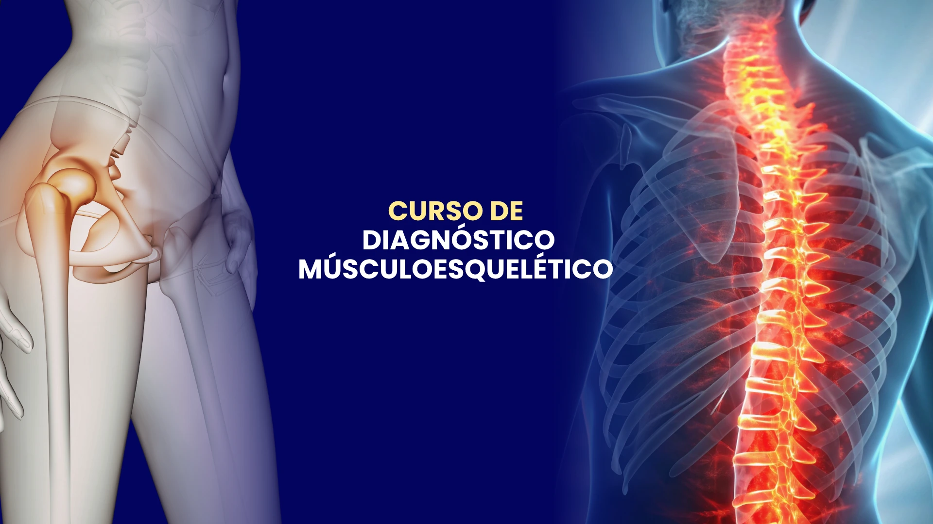 Diagnóstico Musculoesquelético